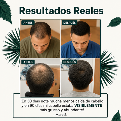 CapilMax®